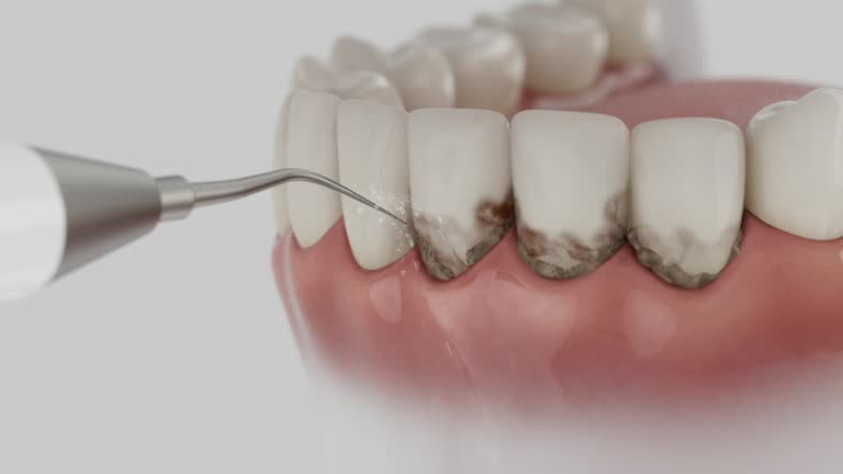 Trusted Root Canal Treatment service in Lexington, MO - Dentist Open Now